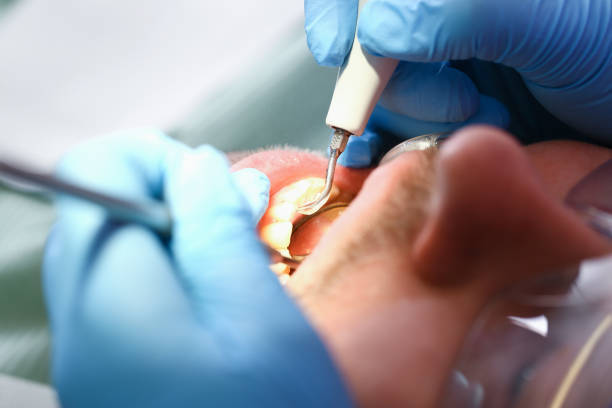 Best Emergency Gum Treatment in Blue Point, NY
